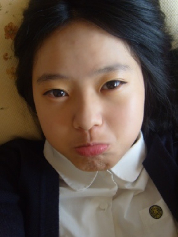 지망 이미지