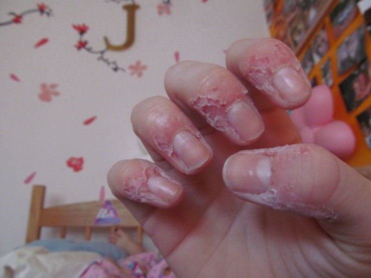 강박증 앓고 있는 여성의 손.jpg (혐오주의) | 인스티즈