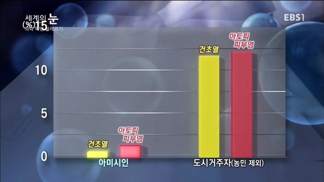 다큐 세계의 눈 - 의학 혁명 알레르기 | 인스티즈