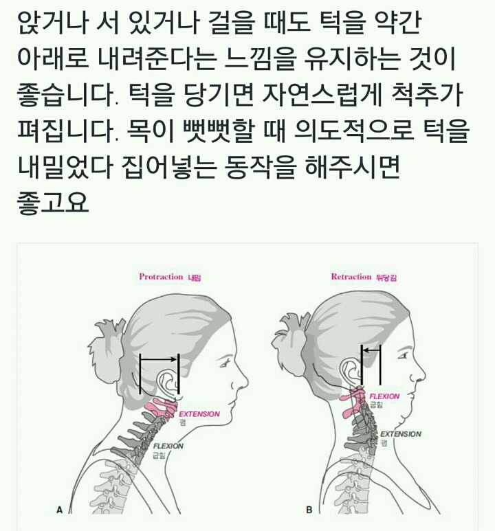 거북 목 스트레칭 | 인스티즈
