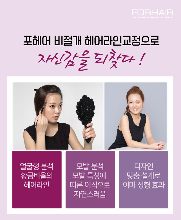미미헤어라인 이미지