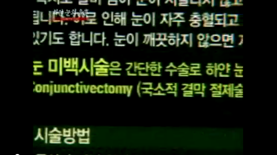 2011년에 퇴출된 성형수술 | 인스티즈