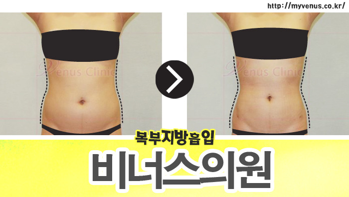 비너스의원 이미지