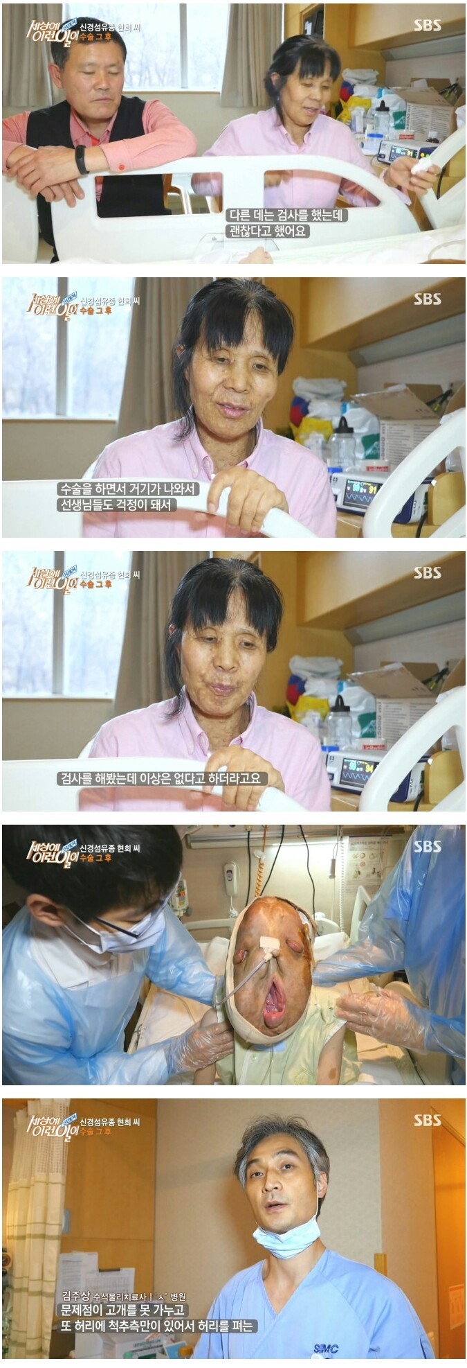  sbs 세상에 이런 일이 현희씨 수술 그 후.jpg | 인스티즈