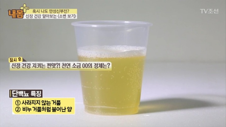 소변 색으로 보는 신장 건강 | 인스티즈